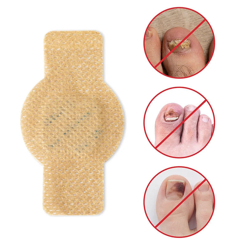 Onychomycosis stickers
